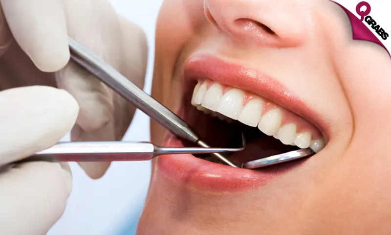 Dental Consultation, Teeth Polishing & Scaling!
